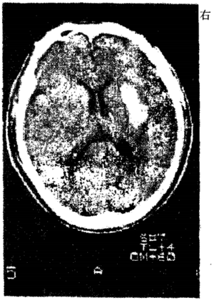 2004临床执业医师-第一单元 P1.png
